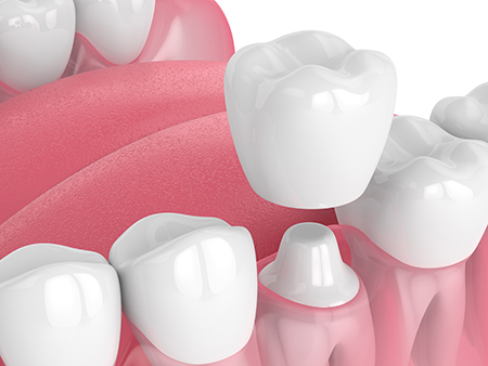 Jill A. Adams, DDS