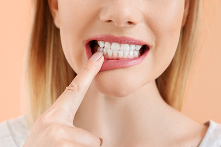 Jill A. Adams, DDS