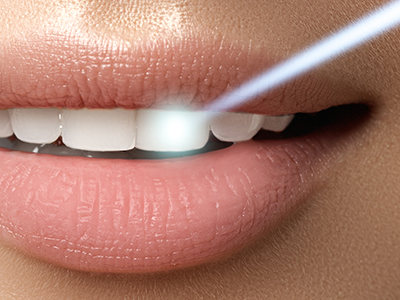 Jill A. Adams, DDS | Preventative Program, Periodontal Treatment and Orthodontics